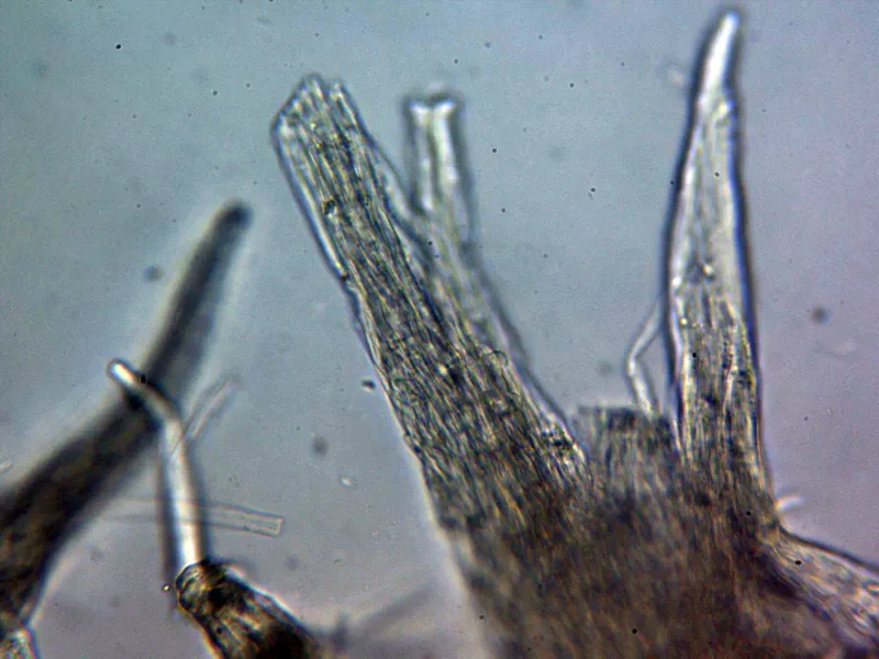 Bjerkandera adusta 10 - Cutícula agua x 400